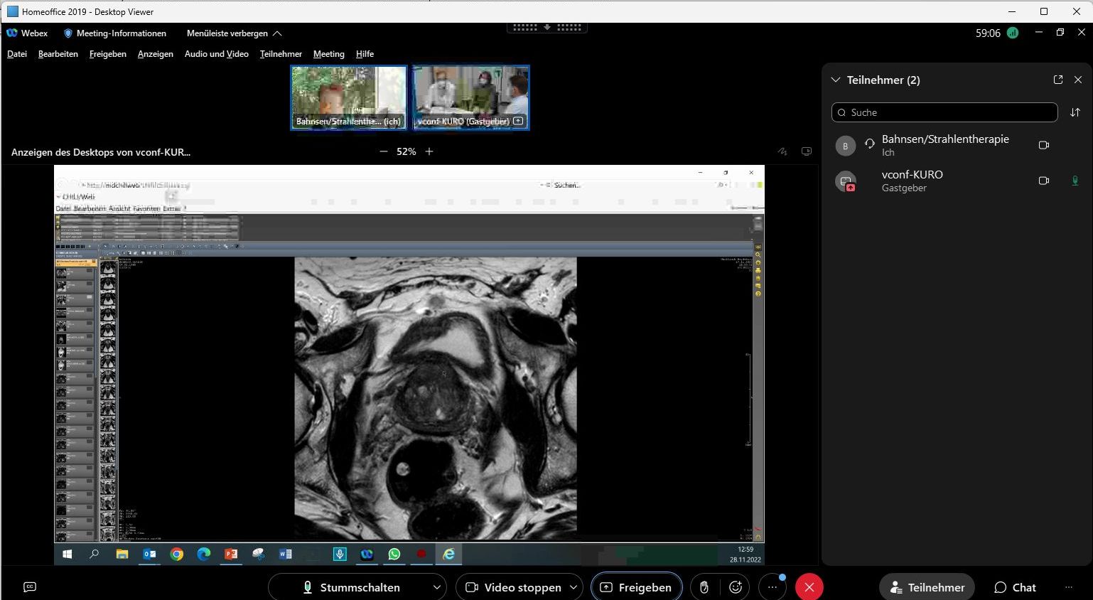 Screen