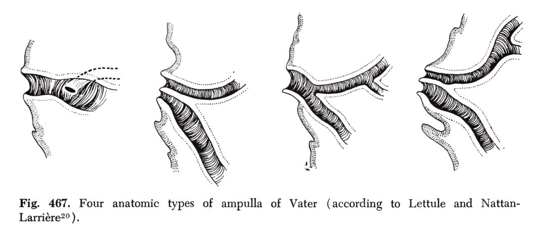 Ampulla Vateri