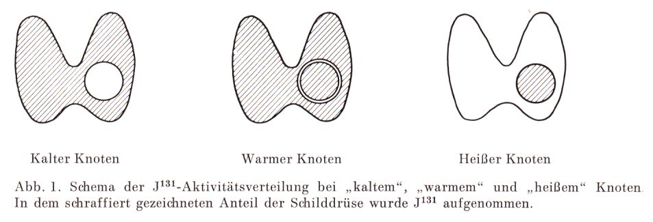 SD-Szintigraphie