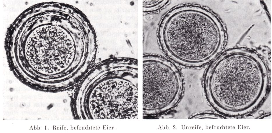 Eier Ascaris