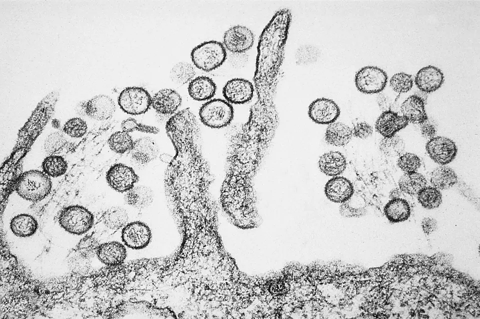 Hanta-Virus