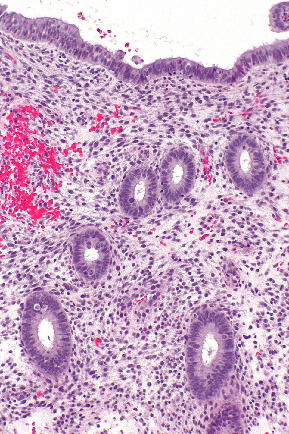 Proliferationsphase