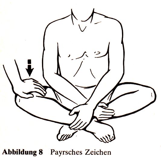 Peyer Zeichen