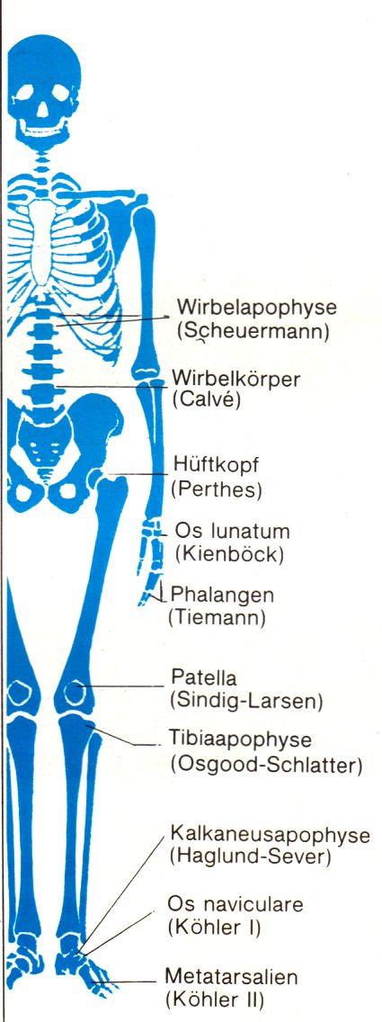 aseptische Knochennekrosen