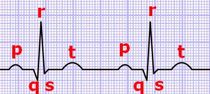 EKG-Wellen