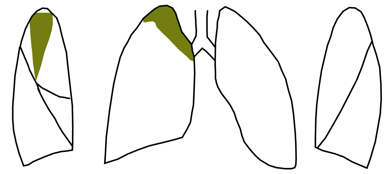 S10