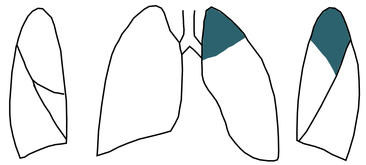 S10