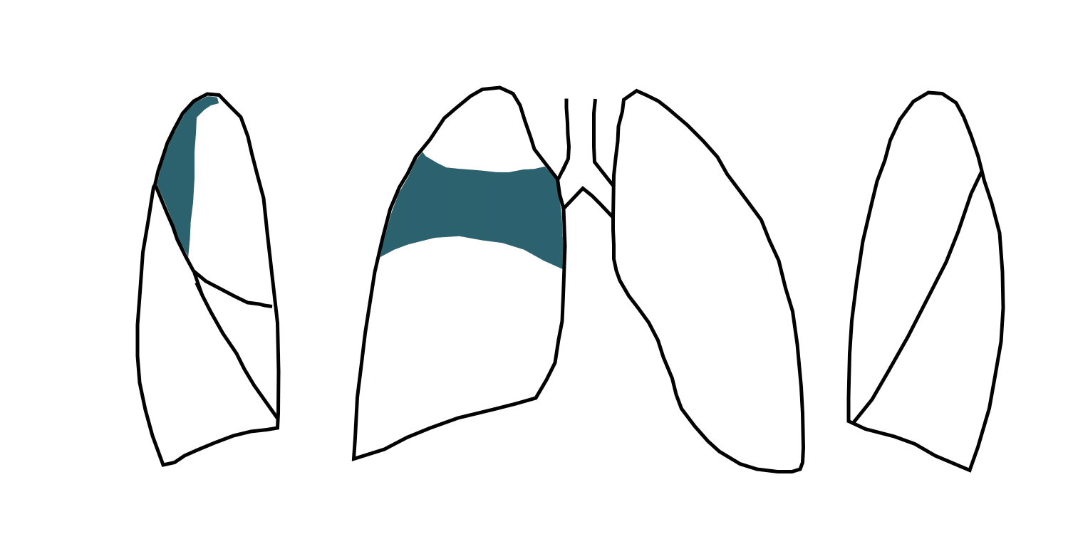 S10