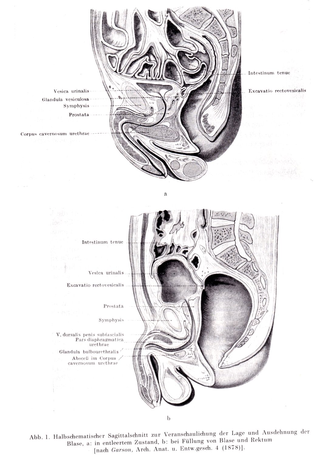 Blase sagittal