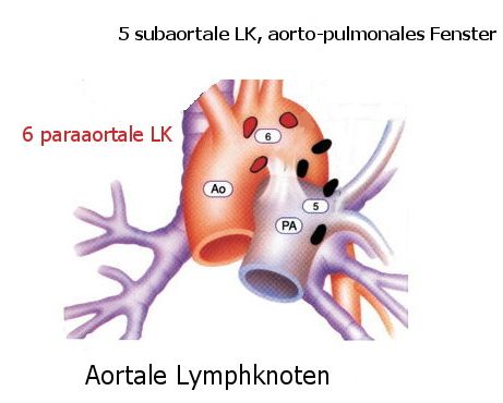 Aortale LK