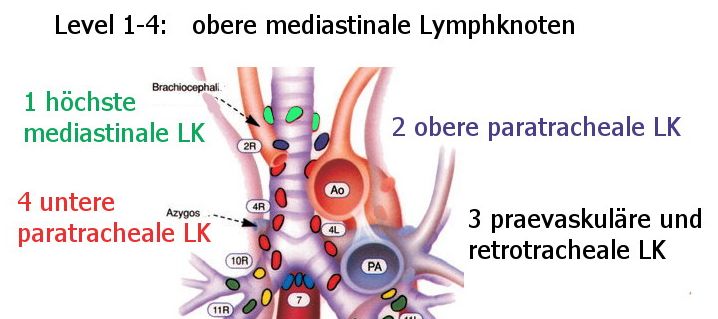 obere mediastinale LK