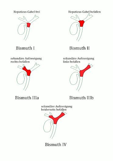 Bismuth-Einteilung