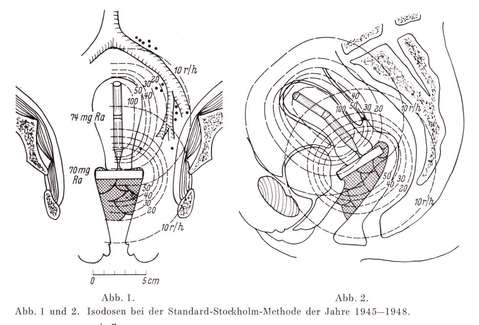 Stockholmer Methode