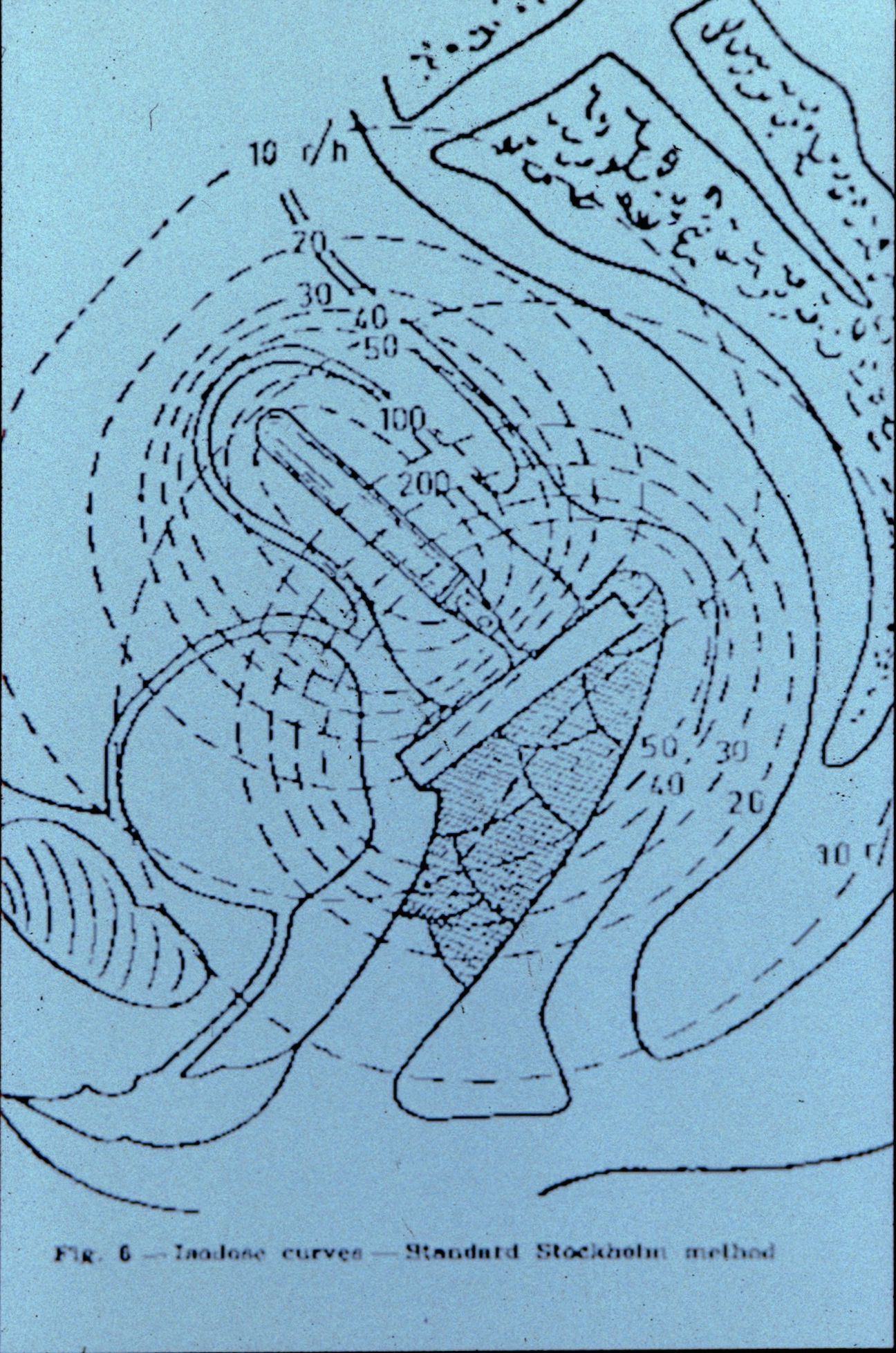 Stockholmer Methode