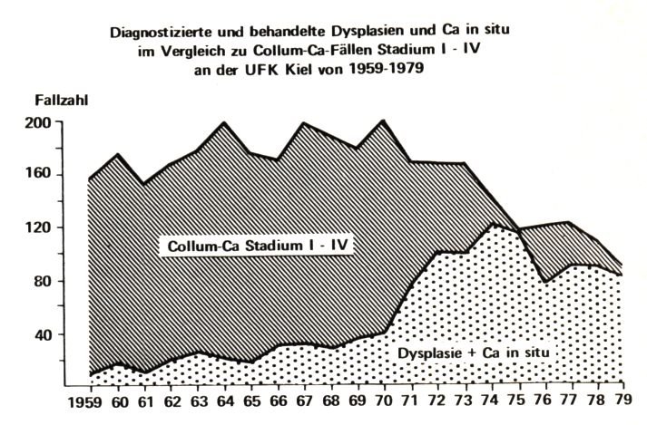 UFK Kiel 1959-1979