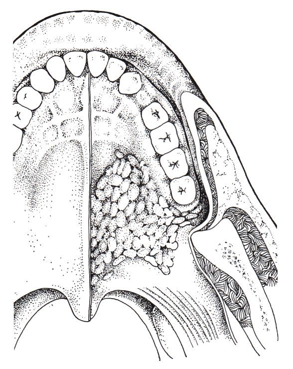 Gaumen