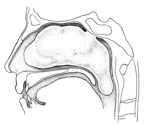 Fibrom