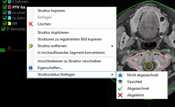 abzeichnen