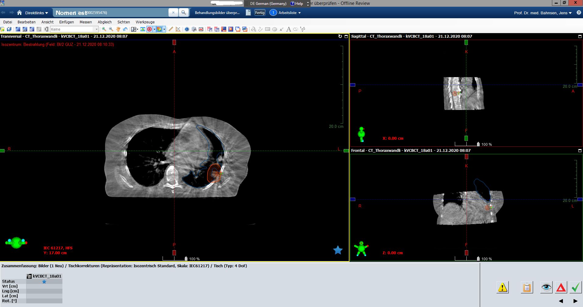 CBCT