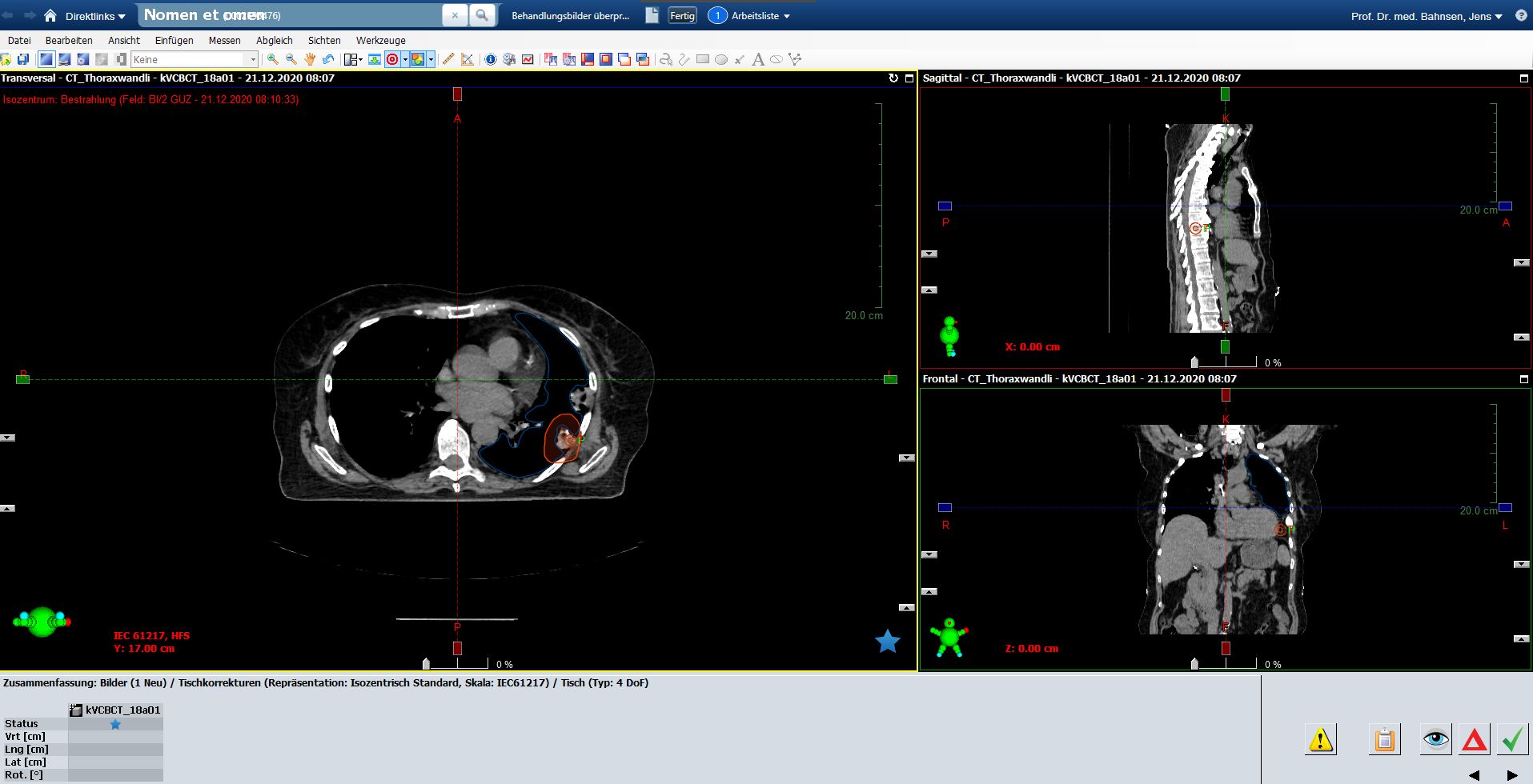 CBCT