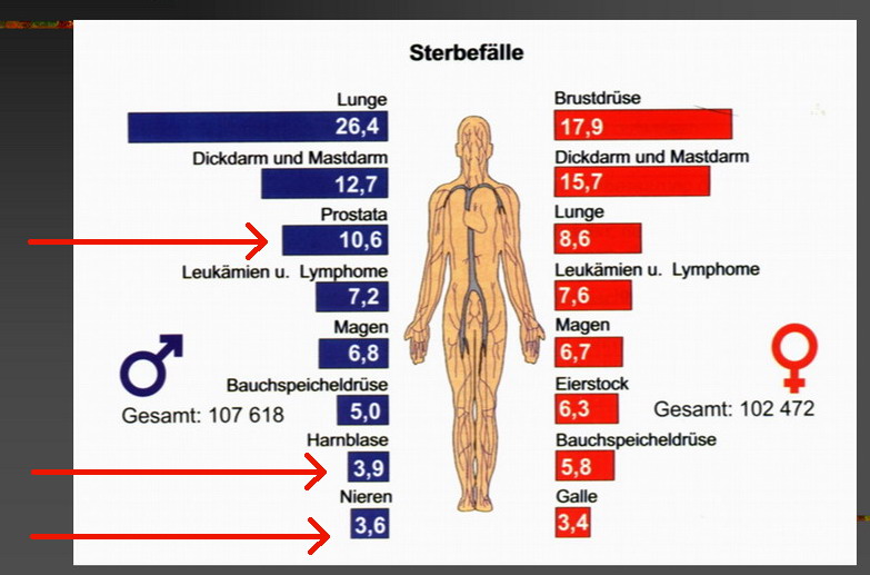 Mortalität urologischer Tumore